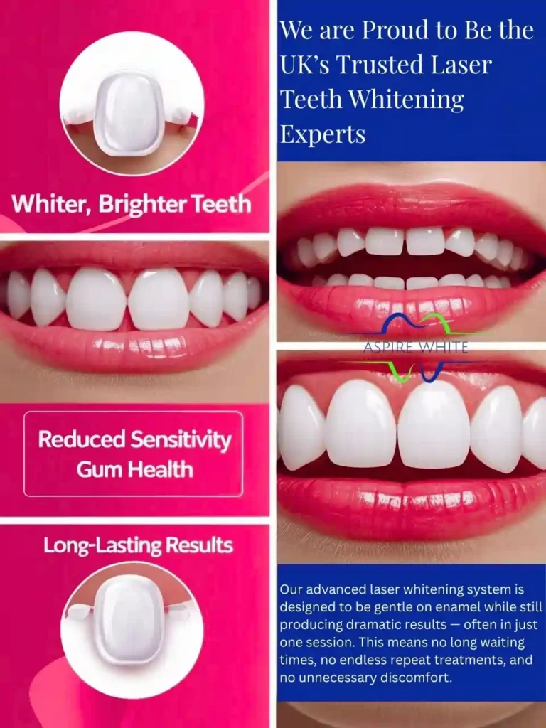 We are Proud to Be the UK’s Trusted Laser Teeth Whitening Experts Dartford